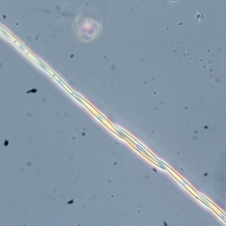 Pseudo-nitzschia