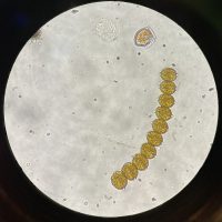 Round Alexandrium cells chained together, with a shield-shaped Dinophysis cell to the top-left of the chain.