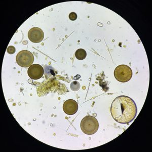 Phytoplankton cells as seen through a microscope, including round and pointed shaped organisms.